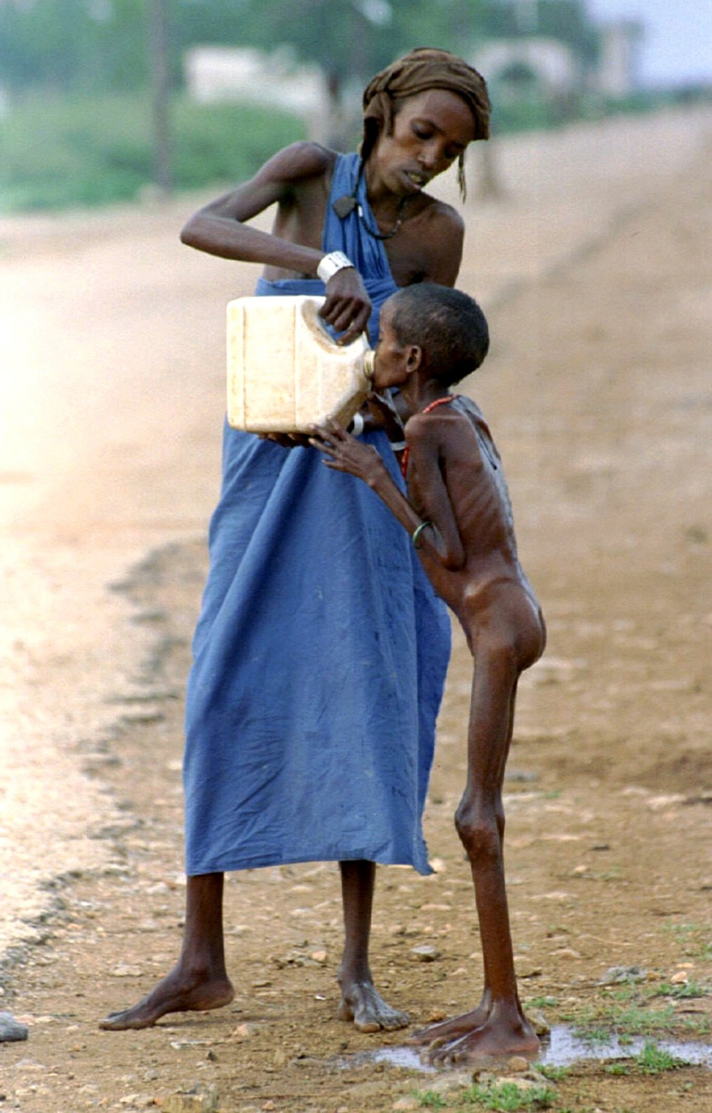 Desnutrición infantil en África: situación actual y fotos reales